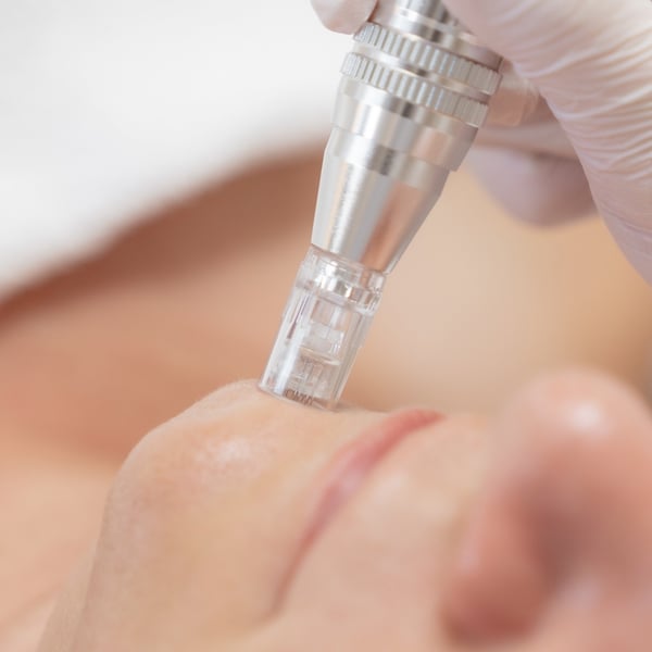 Microneedling
